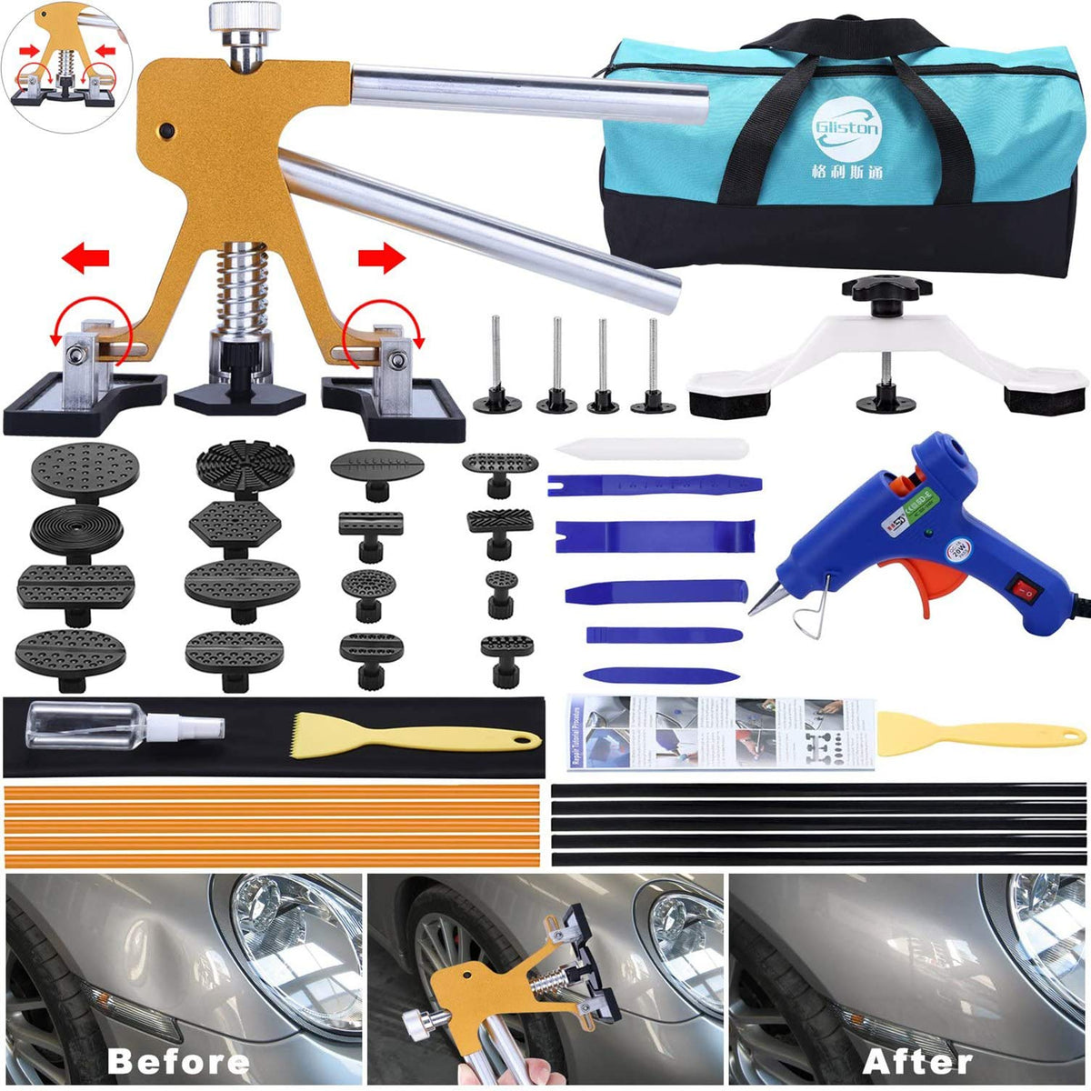GLISTON kit front packaging showing all 45 pieces and organization for quick setup