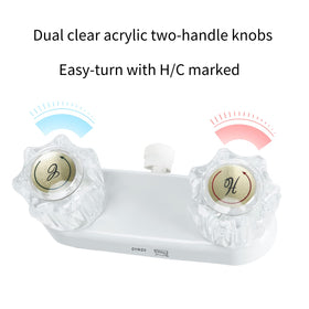 OYMOV acrylic knobs close-up, clear controls for comfortable adjustments
